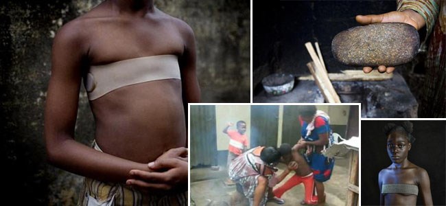 非洲残忍烫乳礼：为防性侵毁掉女孩乳房
